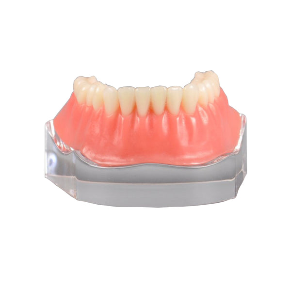 Dental Implant Model with Silver Bar
