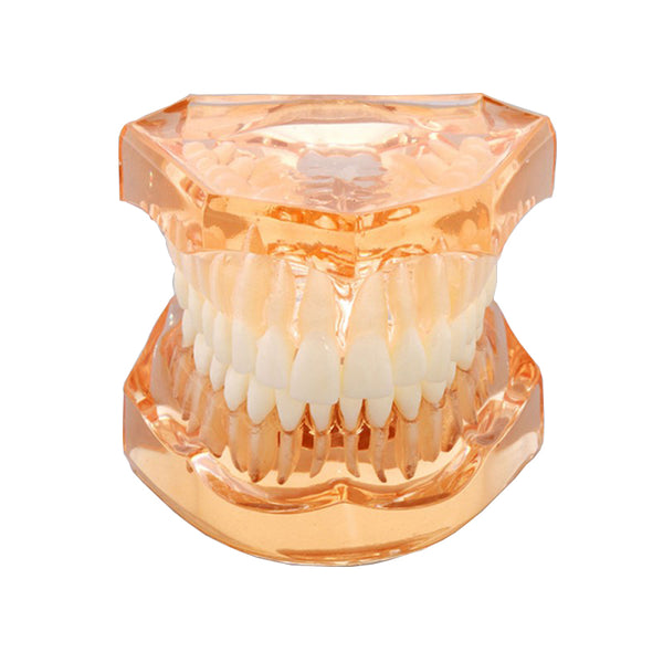 Soft Gum with Removable Teeth without Hinge