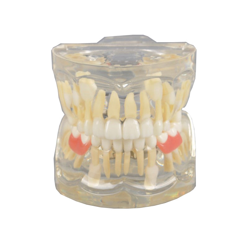 W7019 Mix Dentition Model with Removable Flipper
