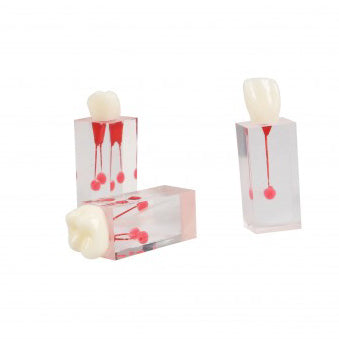 W8004 Root Canal Model for Practice