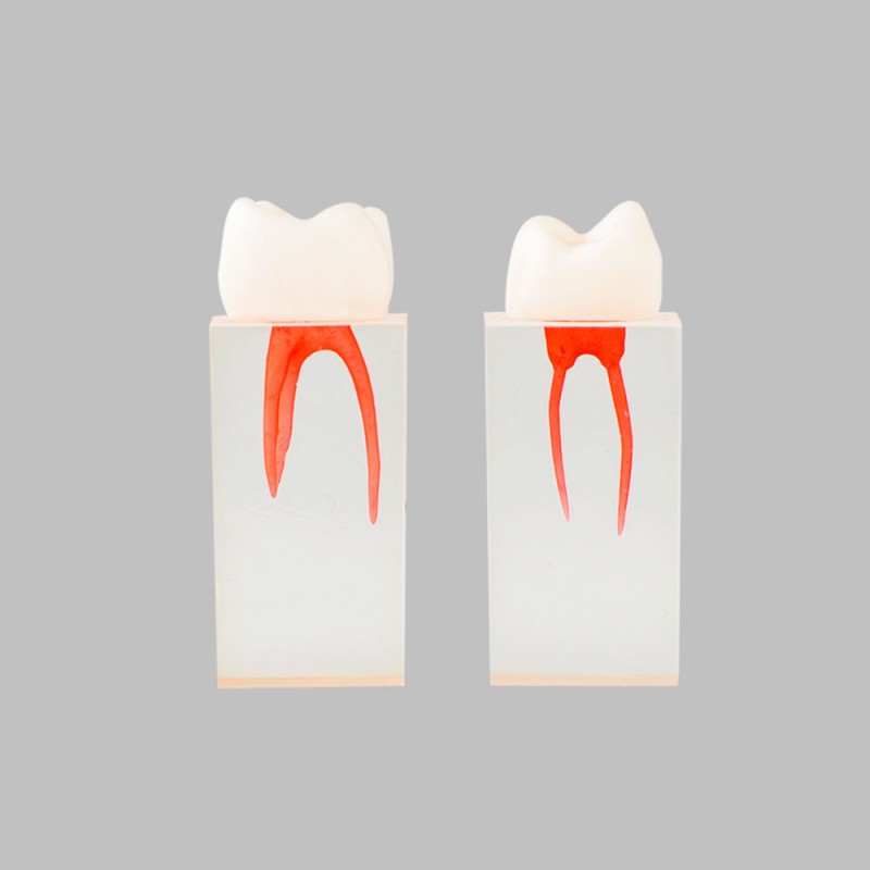 W8005 Root Canal Model for Practice – Dr Wong Anatomy