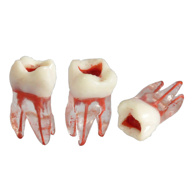 Dental Root Pulp Cavity Model for Training or Practice