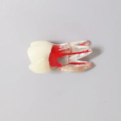 Dental Root Pulp Cavity Model for Training or Practice