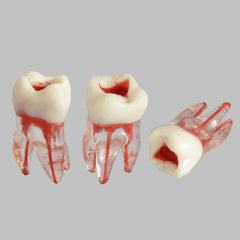 Dental Root Pulp Cavity Model for Training or Practice