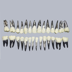 Typodont Practice Model for Orthodontic Practice